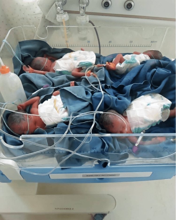 Nyabihu: Impanga enye ziherutse kuvuka hasigaye  umwe.