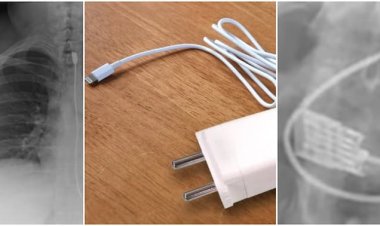 Yamize sharijeri ya Telefone yo mu bwoko bwa i phone