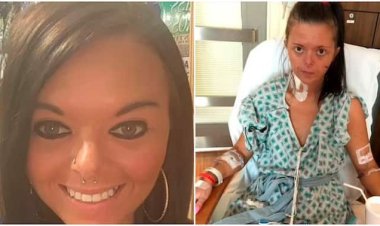 Umukobwa bamusanganye kanseri y'ibihaha nyuma yaho yanywaga isigara 50 ku munsi