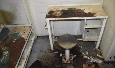 Umugororwa yitabye Imana nyuma yokuribwa n'ibiheri